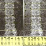 Spine Edge Detection Problem